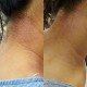 Exzma Skincare Eczema & Psoriasis Premium Relief Gel (10ml)
